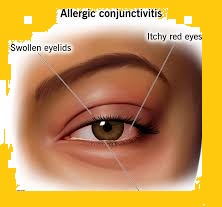 eye